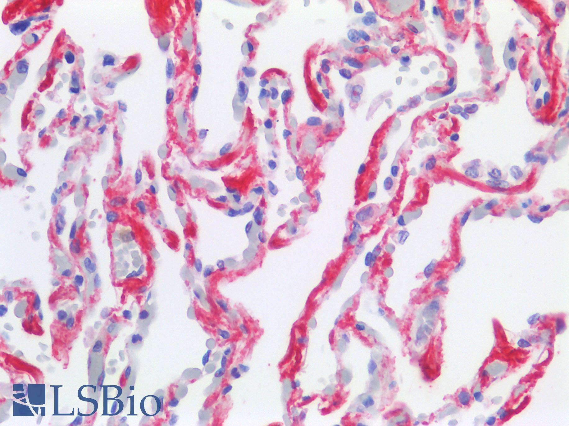 TIMP3 Antibody - Human Lung: Formalin-Fixed, Paraffin-Embedded (FFPE)