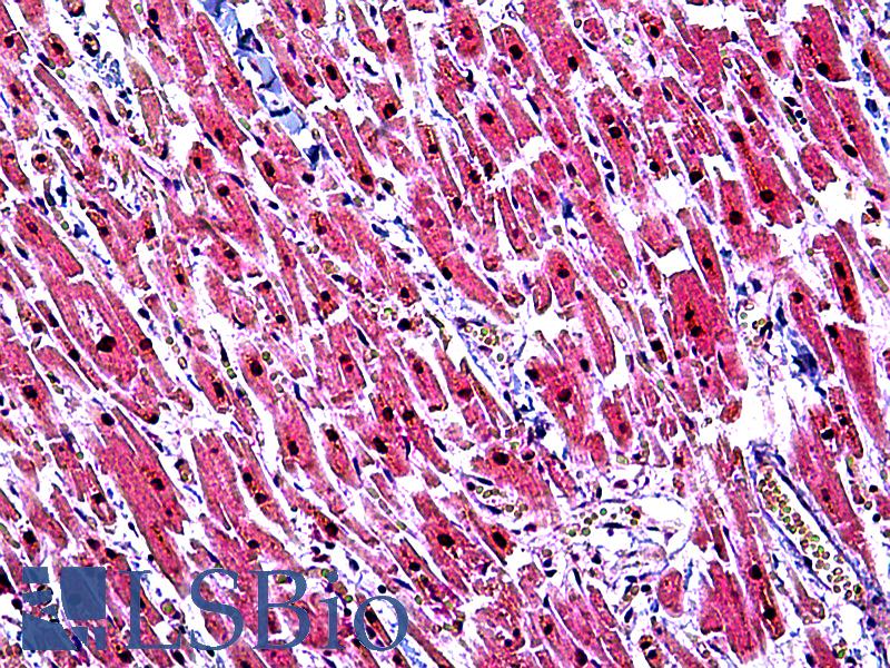 TINF2 Antibody - Anti-TINF2 antibody IHC of human heart. Immunohistochemistry of formalin-fixed, paraffin-embedded tissue after heat-induced antigen retrieval. Antibody concentration 3.75 ug/ml.