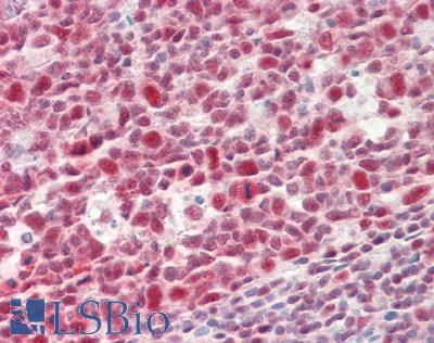 TIP120 / CAND1 Antibody - Human Tonsil: Formalin-Fixed, Paraffin-Embedded (FFPE)