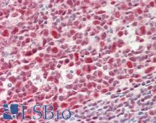 TIP120 / CAND1 Antibody - Human Tonsil: Formalin-Fixed, Paraffin-Embedded (FFPE)