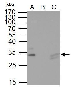 TIP30 / HTATIP2 Antibody - IP Sample: hela whole cell lysate/extract A. 40 µg hela whole cell lysate/extract B. Control with 2 µg of preimmune rabbit IgG C. Immunoprecipitation of TIP30 protein by 2 µg of TIP30 antibody 10% SDS-PAGE The immunoprecipitated TIP30 protein was detected by TIP30 antibody diluted at 1:1000.
