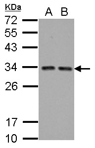 TIP30 / HTATIP2 Antibody - Sample (30 ug of whole cell lysate) A: A431 B: HeLa 12% SDS PAGE HTATIP2 / TIP30 antibody diluted at 1:5000