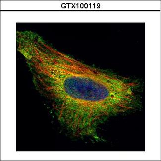 TIP30 / HTATIP2 Antibody - Confocal immunofluorescence analysis (Olympus FV10i) of paraformaldehyde-fixed HeLa, using TIP30 antibody (Green) at 1:500 dilution. Alpha-tubulin filaments were labeled with alpha-tubulin antibody (Red) at 1:2000.
