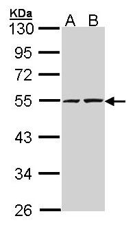 TIP48 / RUVBL2 Antibody - Sample (30 ug of whole cell lysate). A: A431. B: H1299. 10% SDS PAGE. RUVBL2 antibody diluted at 1:5000. 