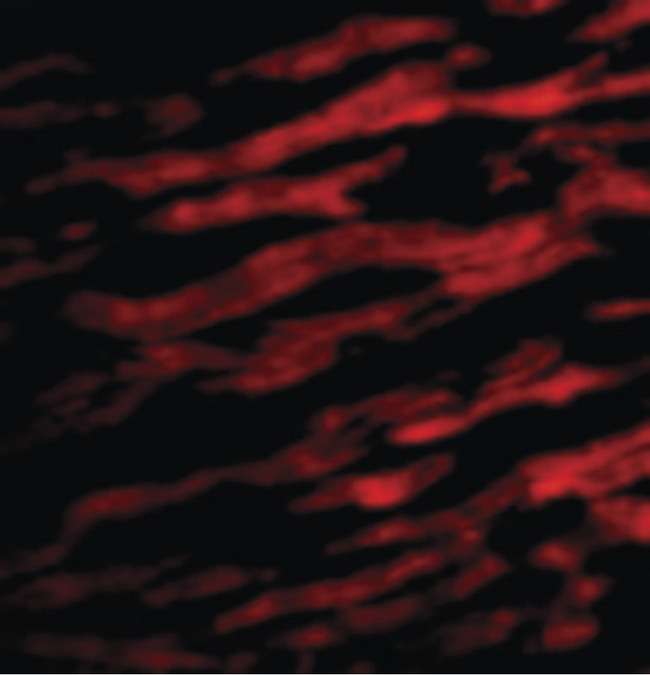 TIRAP Antibody - Immunofluorescence of TIRAP in Human Heart cells with TIRAP antibody at 20 ug/ml.