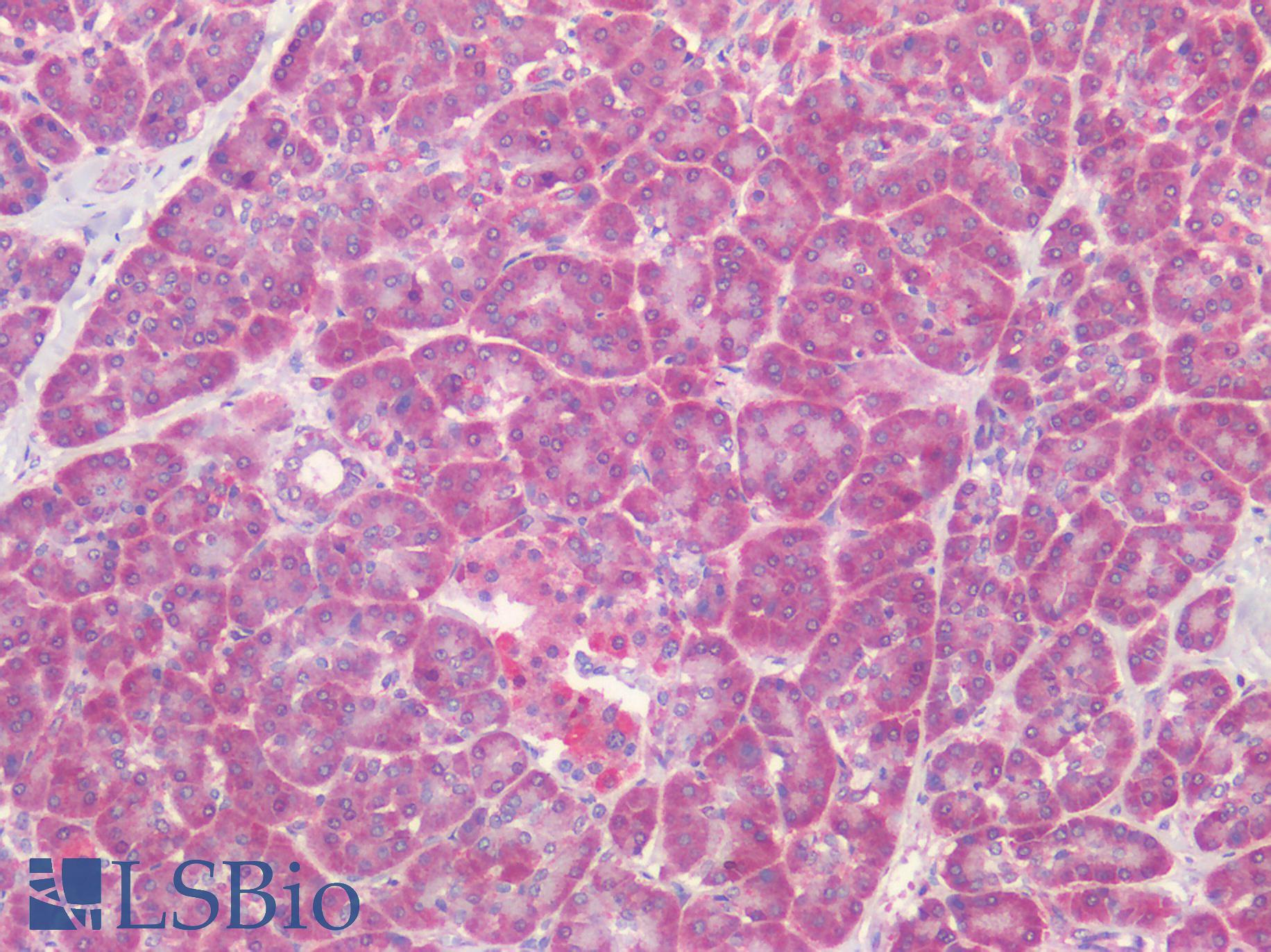 TIRC7 / TCIRG1 Antibody - Human Pancreas: Formalin-Fixed, Paraffin-Embedded (FFPE)