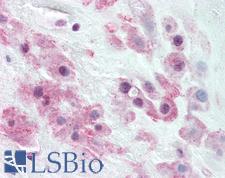 TJP2 / ZO2 / ZO-2 Antibody - Anti-TJP2 / ZO-2 antibody IHC of human placenta, intermediate trophoblasts. Immunohistochemistry of formalin-fixed, paraffin-embedded tissue after heat-induced antigen retrieval. Antibody concentration 10 ug/ml.