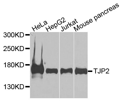 TJP2 / ZO2 / ZO-2 Antibody - Western blot analysis of extracts of various cell lines, using TJP2 antibody at 1:1000 dilution. The secondary antibody used was an HRP Goat Anti-Rabbit IgG (H+L) at 1:10000 dilution. Lysates were loaded 25ug per lane and 3% nonfat dry milk in TBST was used for blocking. An ECL Kit was used for detection and the exposure time was 90s.