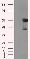 TKT / Transketolase Antibody - HEK293T cells were transfected with the pCMV6-ENTRY control (Left lane) or pCMV6-ENTRY TKT (Right lane) cDNA for 48 hrs and lysed. Equivalent amounts of cell lysates (5 ug per lane) were separated by SDS-PAGE and immunoblotted with anti-TKT.