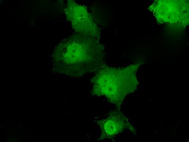 TKT / Transketolase Antibody - Anti-TKT mouse monoclonal antibody  immunofluorescent staining of COS7 cells transiently transfected by pCMV6-ENTRY TKT.