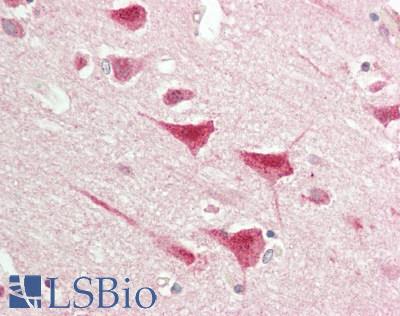 TLE1 / TLE 1 Antibody - Human Brain, Cortex: Formalin-Fixed, Paraffin-Embedded (FFPE)