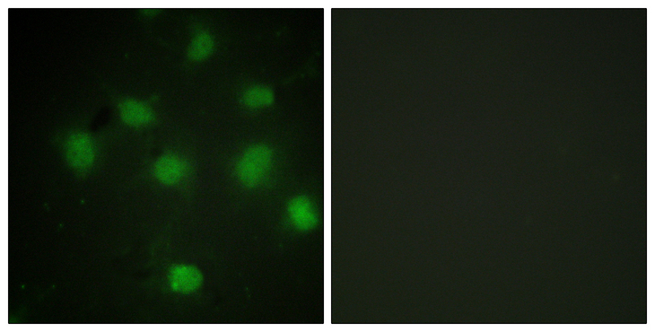 TLK1 Antibody - Immunofluorescence analysis of COS7 cells, using TLK1 Antibody. The picture on the right is blocked with the synthesized peptide.