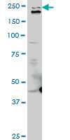 TLN1 / Talin 1 Antibody - TLN1 monoclonal antibody clone 2E10. Western blot of TLN1 expression in Raw 264.7.