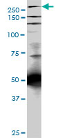 TLN1 / Talin 1 Antibody - TLN1 monoclonal antibody clone 5C1. Western blot of TLN1 expression in PC-12.