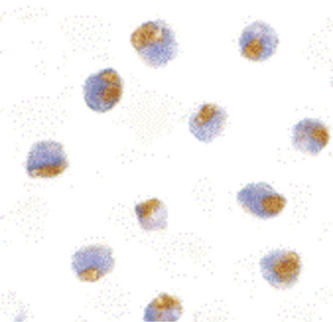 TLR1 Antibody - Immunocytochemistry of TLR1 in Daudi with TLR1 antibody at 10 ug/ml.