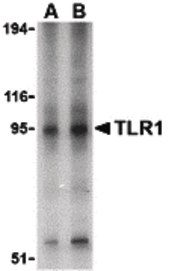 TLR1 Antibody - Western blot of TLR1 in Daudi cell lysate with TLR1 antibody at (A) 1 and (B) 2 ug/ml.