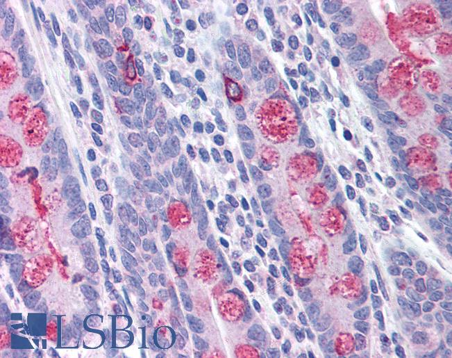 TLR1 Antibody - Anti-TLR1 antibody IHC of human small intestine. Immunohistochemistry of formalin-fixed, paraffin-embedded tissue after heat-induced antigen retrieval. Antibody concentration 5 ug/ml.