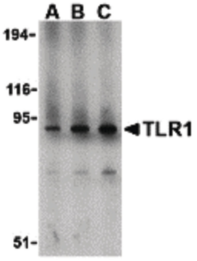 TLR1 Antibody - Western blot of TLR1 in mouse spleen lysate with TLR1 antibody at (A) 1, (B) 2, and (C) 4 ug/ml.