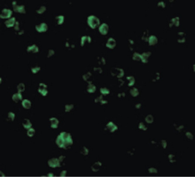 TLR10 Antibody - Immunofluorescence of TLR10 in Daudi cells with TLR10 antibody at 2 ug/ml.