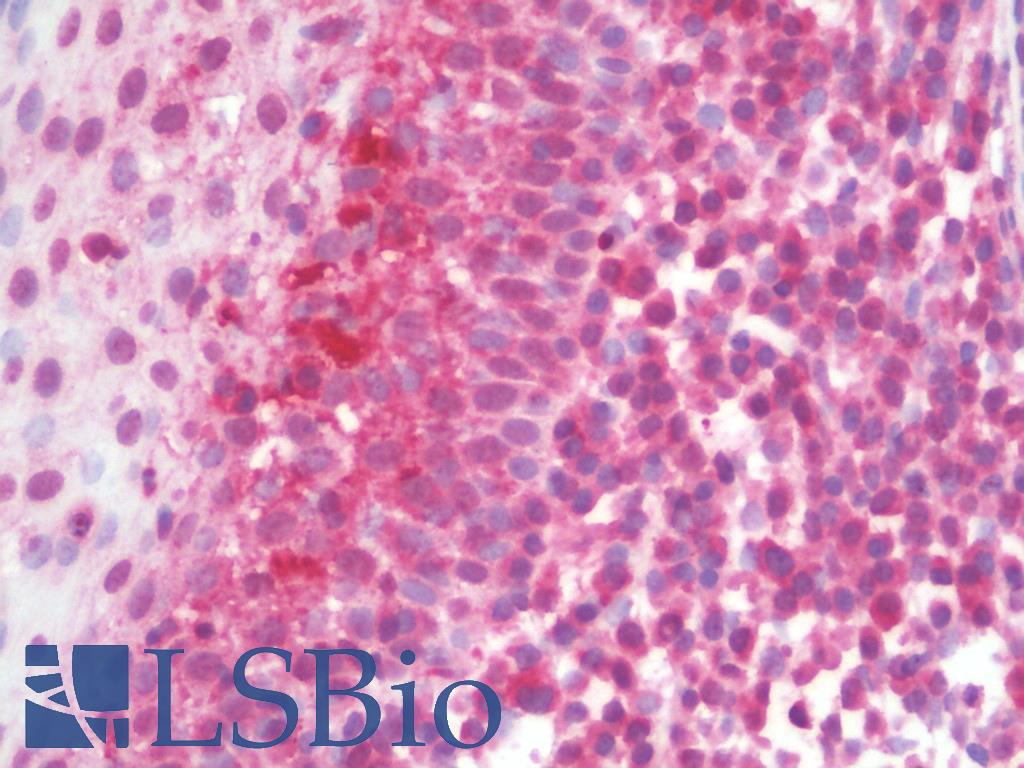 TLR10 Antibody - Anti-TLR10 antibody IHC staining of human tonsil. Immunohistochemistry of formalin-fixed, paraffin-embedded tissue after heat-induced antigen retrieval. Antibody concentration 5 ug/ml.