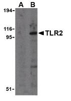TLR2 Antibody - Western blot of TLR2 in A20 cell lysates with TLR2 antibody at 1 ug/ml in the presence (A) and absence (B) of its blocking peptide.