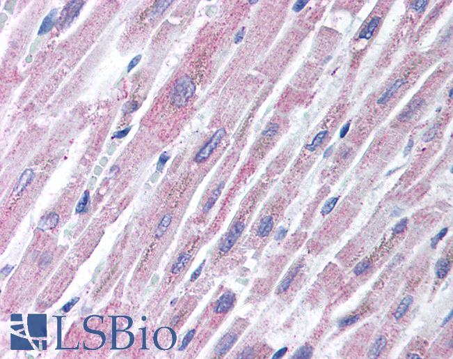 TLR2 Antibody - Anti-TLR2 antibody IHC of human heart. Immunohistochemistry of formalin-fixed, paraffin-embedded tissue after heat-induced antigen retrieval. Antibody concentration 2 ug/ml.