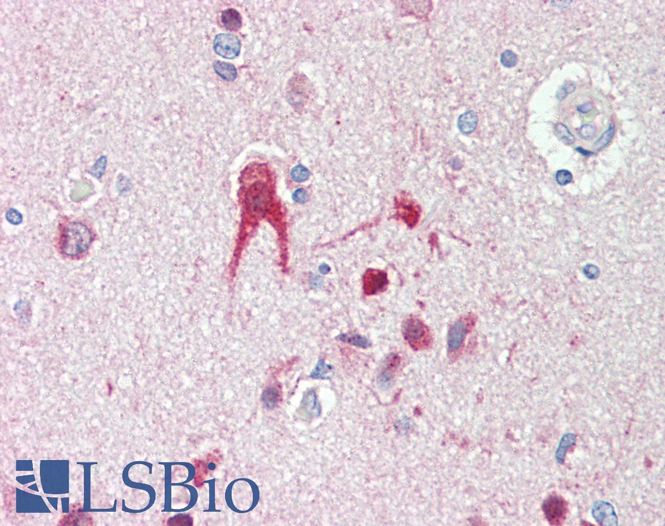 TLR2 Antibody - Anti-TLR2 antibody IHC staining of human brain, cortex. Immunohistochemistry of formalin-fixed, paraffin-embedded tissue after heat-induced antigen retrieval. Antibody concentration 5 ug/ml.