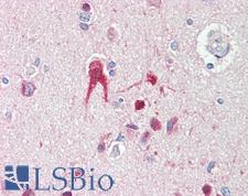 TLR2 Antibody - Anti-TLR2 antibody IHC staining of human brain, cortex. Immunohistochemistry of formalin-fixed, paraffin-embedded tissue after heat-induced antigen retrieval. Antibody concentration 5 ug/ml.