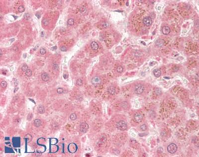 TLR3 Antibody - Human Liver: Formalin-Fixed, Paraffin-Embedded (FFPE)