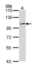 TLR3 Antibody - Sample (30 ug of whole cell lysate). A: Molt-4. 7.5% SDS PAGE. TLR3 antibody diluted at 1:5000. 