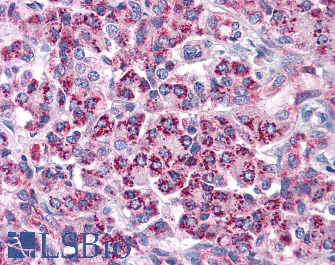 TLR3 Antibody - Anti-TLR3 antibody IHC of human pancreas. Immunohistochemistry of formalin-fixed, paraffin-embedded tissue after heat-induced antigen retrieval. Antibody concentration 10 ug/ml.