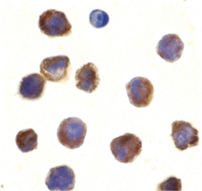 TLR3 Antibody - Immunocytochemistry of TLR3 in K562 cells with TLR3 antibody at 10 ug/ml.