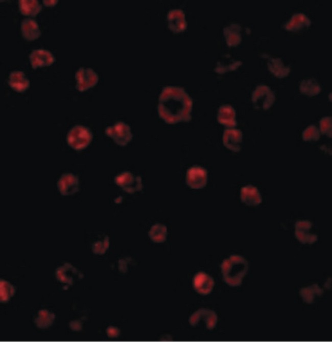 TLR3 Antibody - Immunofluorescence of TLR3 in K562 cells with TLR3 antibody at 2 ug/ml.