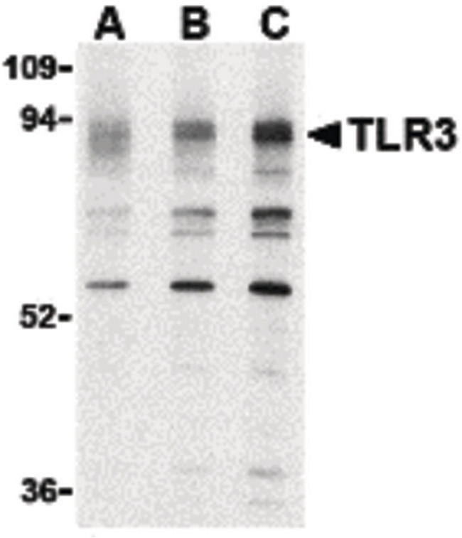 TLR3 Antibody - Western blot of TLR3 in K562 cell lysate with TLR3 antibody at (A) 0.5, (B) 1 and (C) 2 ug/ml.