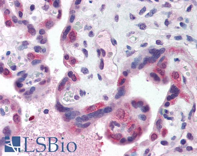TLR3 Antibody - Anti-TLR3 antibody IHC of human placenta. Immunohistochemistry of formalin-fixed, paraffin-embedded tissue after heat-induced antigen retrieval. Antibody concentration 5 ug/ml.