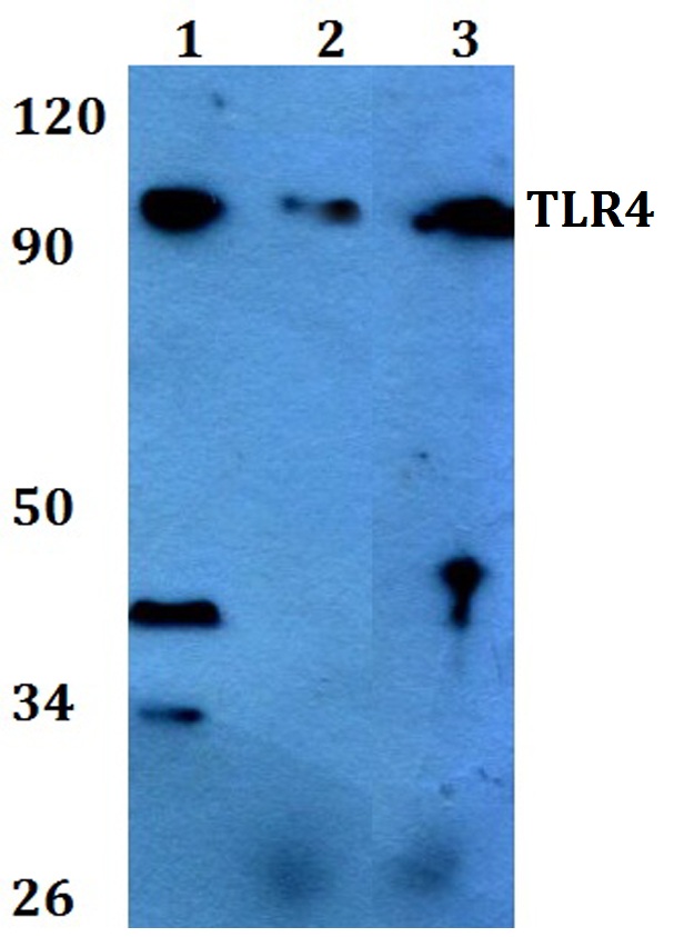 TLR4 Antibody - Western blot (WB) analysis of Anti-TLR4 pAb at 1:500 dilution. Lane1: HEK293T whole cell lysate. Lane2: sp2/0 whole cell lysate. Lane3: H9C2 whole cell lysate.