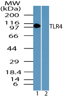 TLR4 Antibody - Western blot of TLR4 in human intestine lysate in the 1) absence and 2) presence of immunizing peptide using TLR4 antibody at 0.1 ug/ml. Goat anti-rabbit Ig HRP secondary antibody, and PicoTect ECL substrate solution, were used for this test.