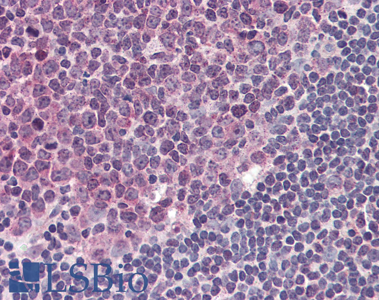 TLR4 Antibody - Anti-TLR4 antibody IHC of human tonsil. Immunohistochemistry of formalin-fixed, paraffin-embedded tissue after heat-induced antigen retrieval. Antibody concentration 5 ug/ml.
