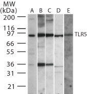 TLR5 Antibody - Western blot of TLR5 in (A) Ramos, (B) Raw, (C) mouse spleen, (D) mouse lung and (E) rat lung whole cell lysate using antibody at 2 ug/ml.