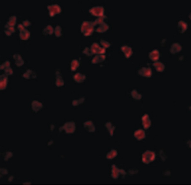 TLR5 Antibody - Immunofluorescence of TLR5 in THP1 cells with TLR5 antibody at 10 ug/ml.