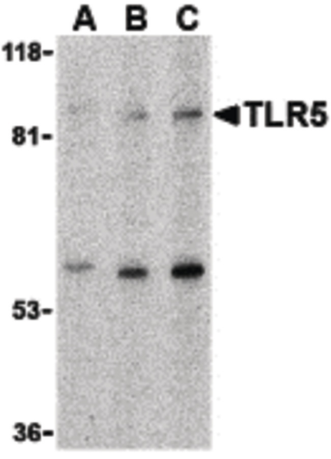TLR5 Antibody - Western blot of TLR5 in THP-1 cell lysate with TLR5 antibody at (A) 0.5, (B) 1 and (C) 2 ug/ml.