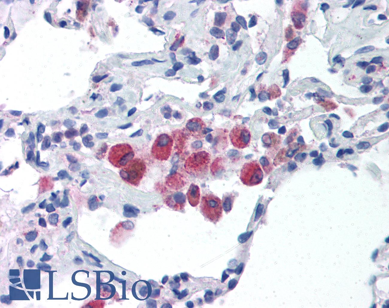 TLR5 Antibody - Anti-TLR5 antibody IHC of human lung. Immunohistochemistry of formalin-fixed, paraffin-embedded tissue after heat-induced antigen retrieval. Antibody concentration 5 ug/ml.