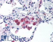 TLR5 Antibody - Anti-TLR5 antibody IHC of human lung. Immunohistochemistry of formalin-fixed, paraffin-embedded tissue after heat-induced antigen retrieval. Antibody concentration 5 ug/ml.
