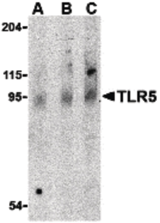 TLR5 Antibody - Western blot of TLR5 in rat brain cell lysate with TLR5 antibody at (A) 0.5, (B) 1 and (C) 2 ug/ml.