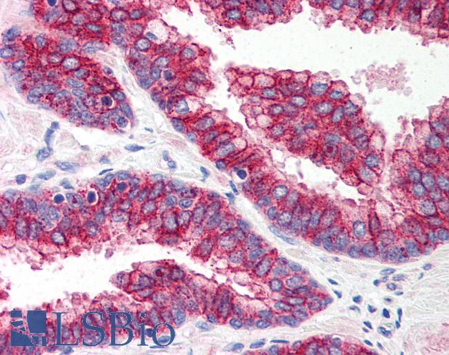 TLR5 Antibody - Anti-TLR5 antibody IHC of human prostate. Immunohistochemistry of formalin-fixed, paraffin-embedded tissue after heat-induced antigen retrieval. Antibody concentration 5 ug/ml.