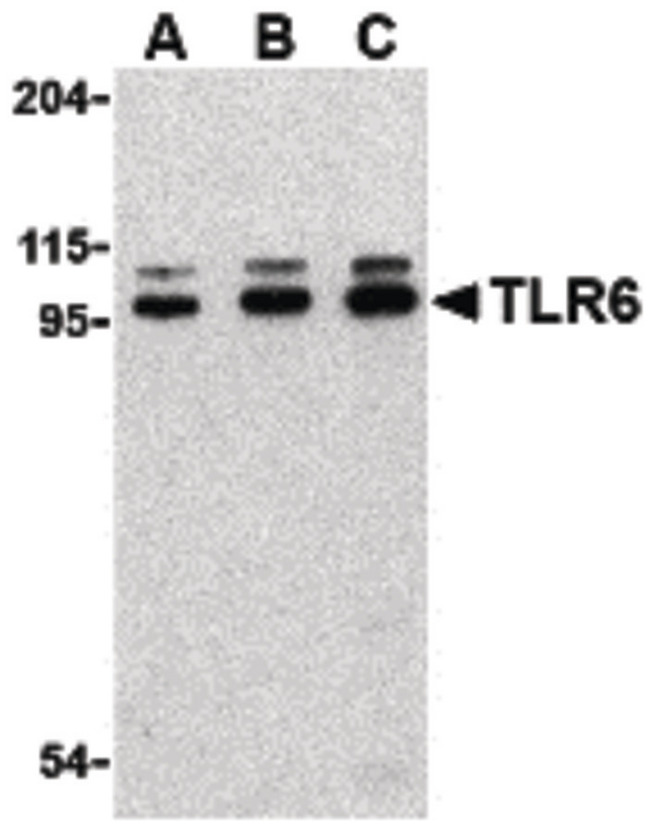 TLR6 Antibody - Western blot of TLR6 in Jurkat cell lysate with TLR6 antibody at (A) 0.5, (B) 1 and (C) 2 ug/ml.