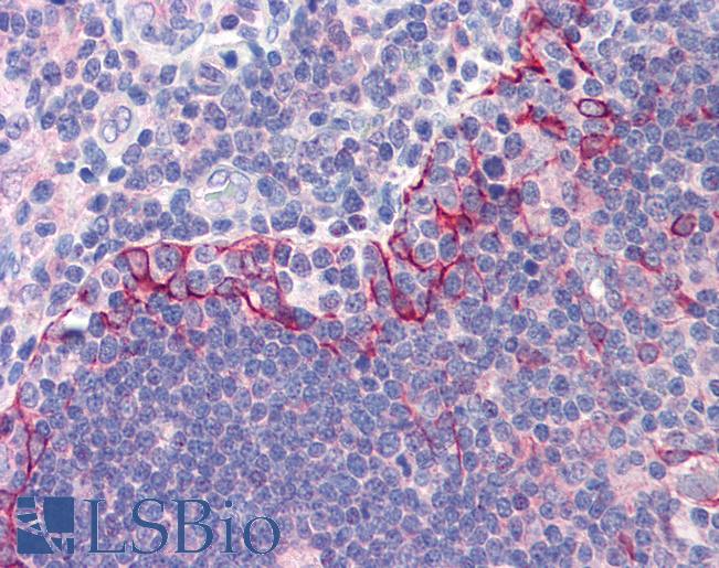 TLR6 Antibody - Anti-TLR6 antibody IHC of human thymus. Immunohistochemistry of formalin-fixed, paraffin-embedded tissue after heat-induced antigen retrieval. Antibody concentration 5 ug/ml.