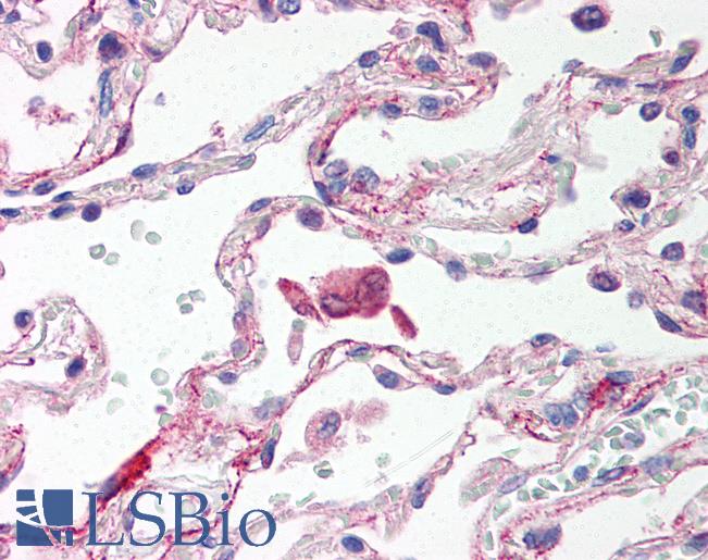 TLR6 Antibody - Anti-TLR6 antibody IHC of human lung, alveolar macrophages. Immunohistochemistry of formalin-fixed, paraffin-embedded tissue after heat-induced antigen retrieval. Antibody concentration 5 ug/ml.