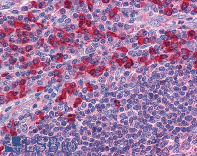 TLR7 / CD287 Antibody - Anti-TLR7 antibody IHC of human tonsil. Immunohistochemistry of formalin-fixed, paraffin-embedded tissue after heat-induced antigen retrieval. Antibody concentration 10 ug/ml.