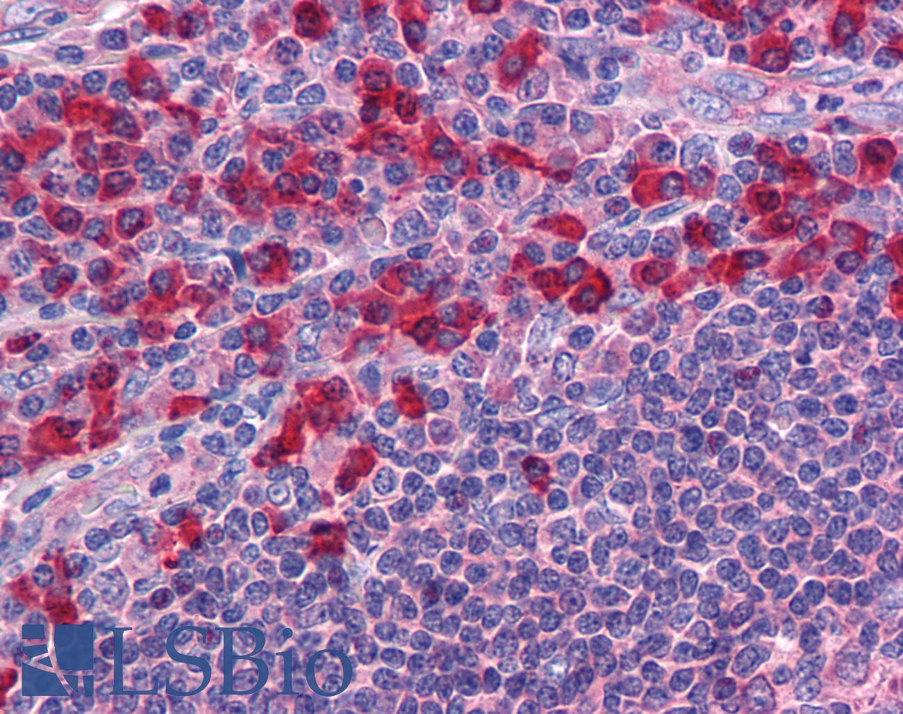 TLR7 / CD287 Antibody - Anti-TLR7 antibody IHC of human tonsil. Immunohistochemistry of formalin-fixed, paraffin-embedded tissue after heat-induced antigen retrieval. Antibody concentration 10 ug/ml.